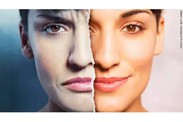 Yaşa Göre Bipolar Bozukluk